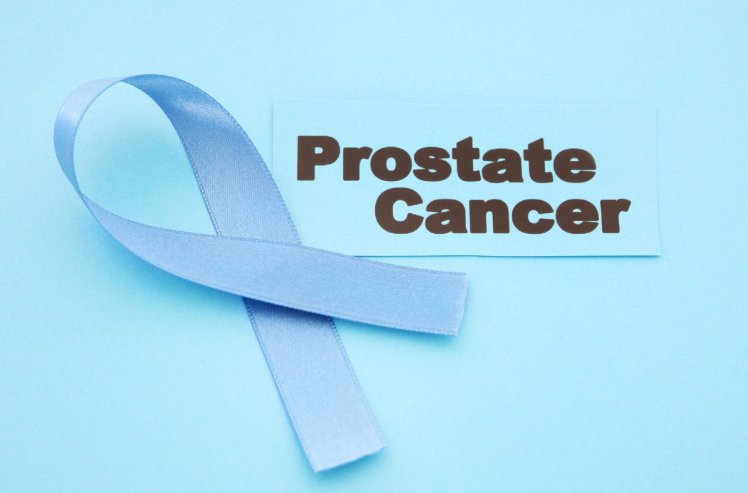 Prostate Cancer - Symptoms and Treatment