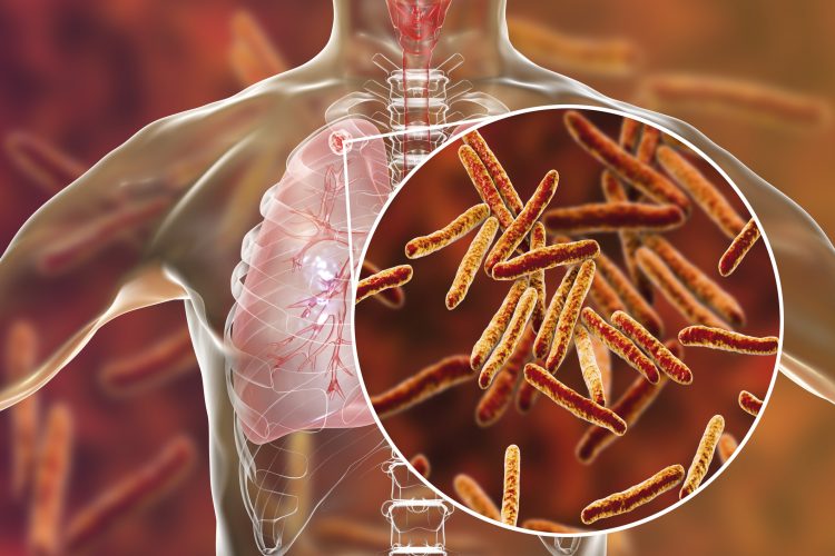 Is TB Curable Disease? TB is a contagious disease and when a patient coughs. The TB bacteria in their mucus spread to other people through the air, thus making the other person a TB patient.